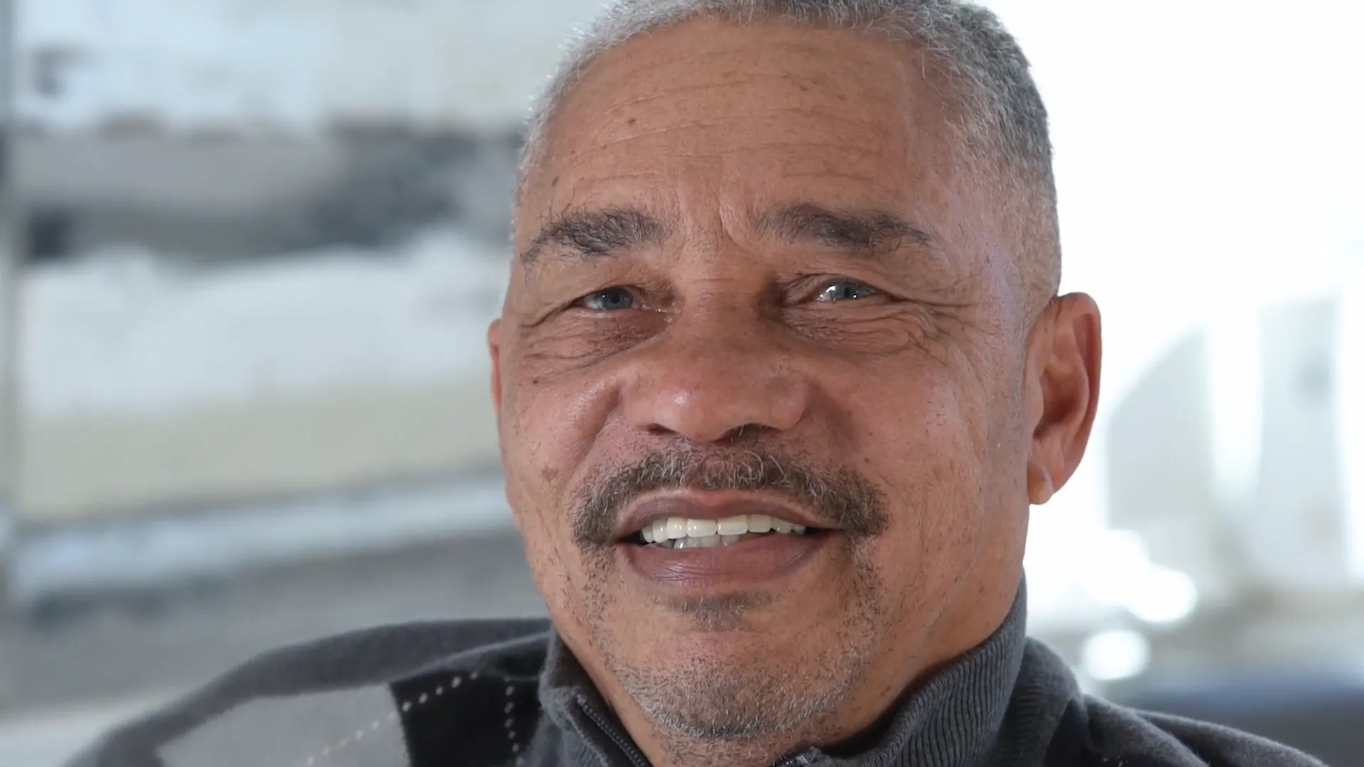 Elmer — All-on-X patient